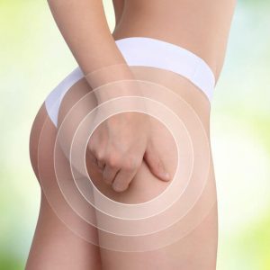 3 conseils pour lutter contre la cellulite - Tuttinutri