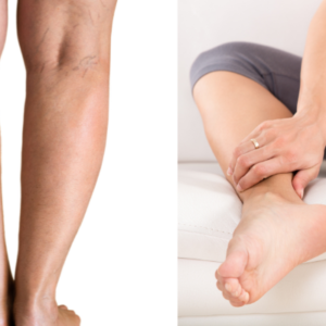 Article remèdes de grand-mère jambes lourdes LMP Santé